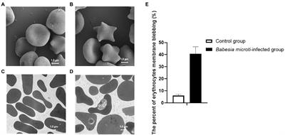 Enhanced phosphatidylserine exposure and erythropoiesis in Babesia microti-infected mice